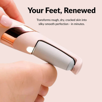 Homiigo™ Electric Callus Remover
