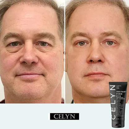 Instant FIRMx Eye Tightener & Eye Care Cream