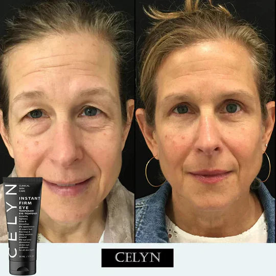 Instant FIRMx Eye Tightener & Eye Care Cream
